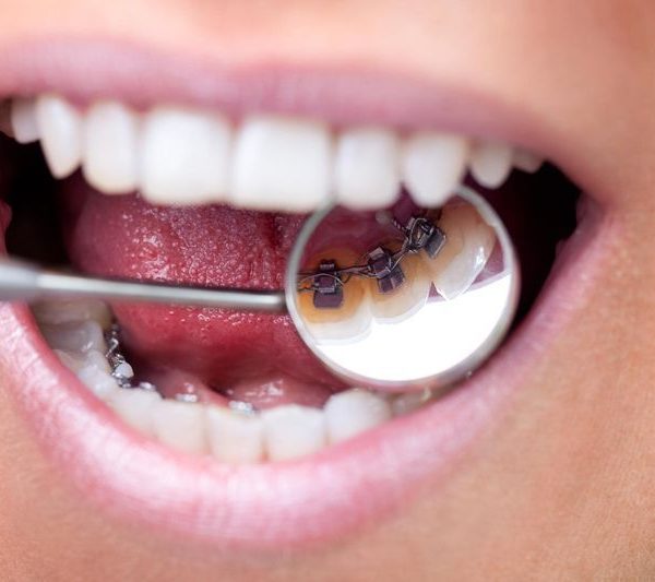 Le Dr Séverin réalise des soins en orthodontie